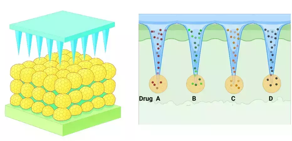 Left: Microneedle array above yellow cells. Right: Four different colored drugs (red, green, orange, black) delivered into skin.